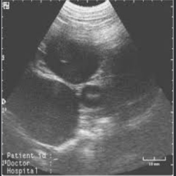 Ultrasonogram Specialist